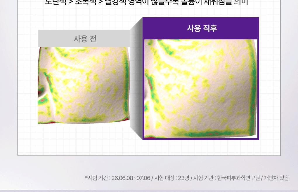 🔥 毛孔隱形小紫瓶！新品✨MEDIHEAL PDRN 毛孔彈力精華💜 MEDIHEAL DERMA SERUM PDRN PORE