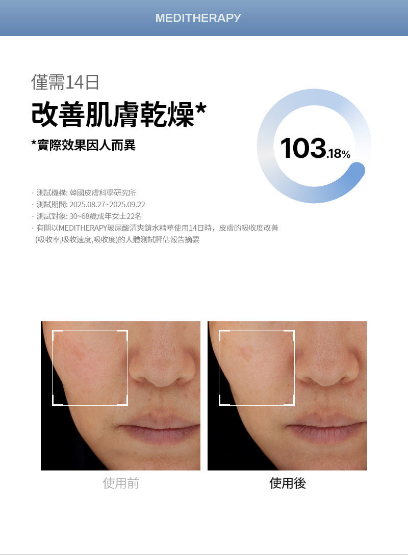 韓國美妝達人PONY自用推薦💫 乾燥肌救星！ MEDITHERAPY 玻尿酸清爽肌底修護鎖水精華💧| HYALURONIC ACID SKIN BOOSTER FIRST SERUM 打造完美貼膚底妝✨