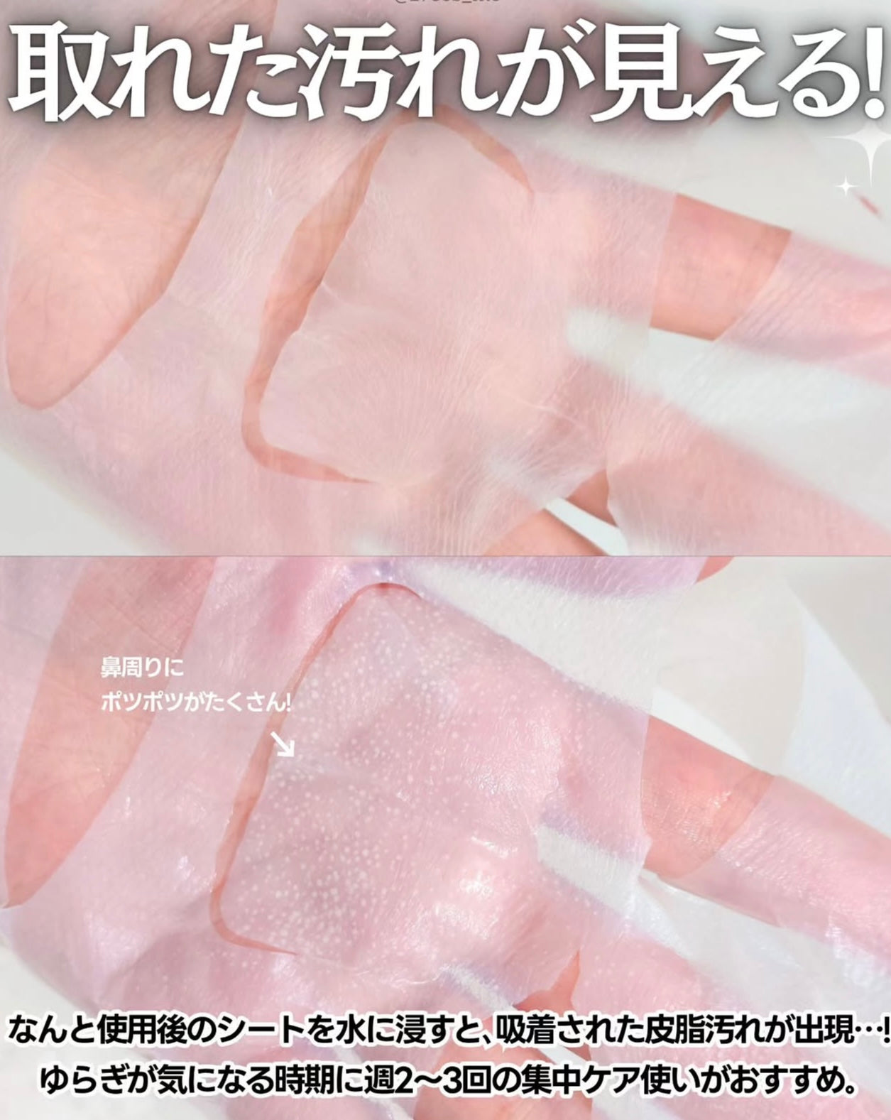 全面瑕疵的大型救星✨ EIoM 縮時淨痘粉刺調理修護面膜EIoM Trouble Patch Mask