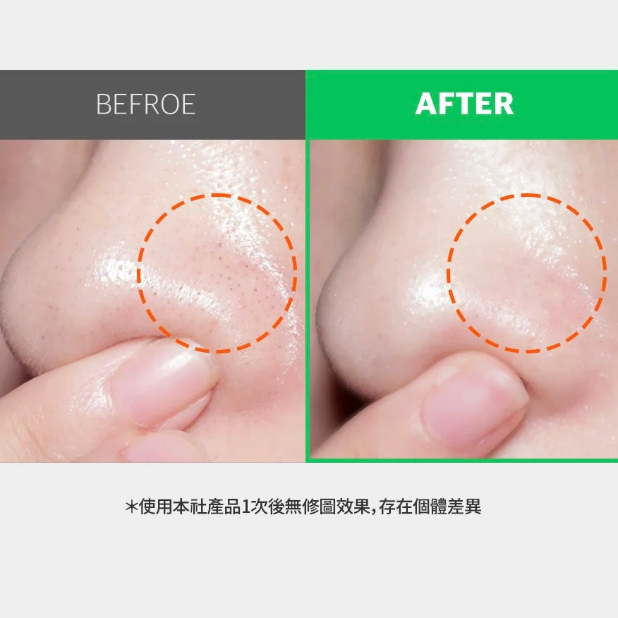 Sungboon Editor綠番茄精華淨化毛孔雙效卸妝油🍅💚| Sungboon Editor Green Tomato Deep Pore Double Cleansing Ampoule Oil