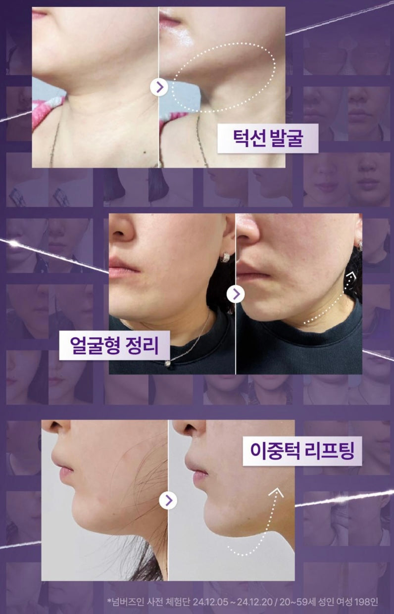 送拉提帶🔥Numbuzin NMN BIO 9號全面提拉緊緻全效面膜💜居家版「微整級」護理🔥