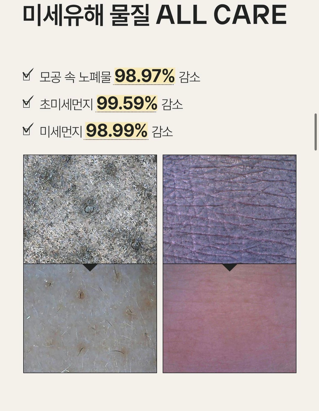 油肌救星 ⭐️Oganacell 高濃度胜肽控油煥膚潔面凝膠 | DERX™ Cleanser Turnover Sebum Control 醫美院線級產品🏥