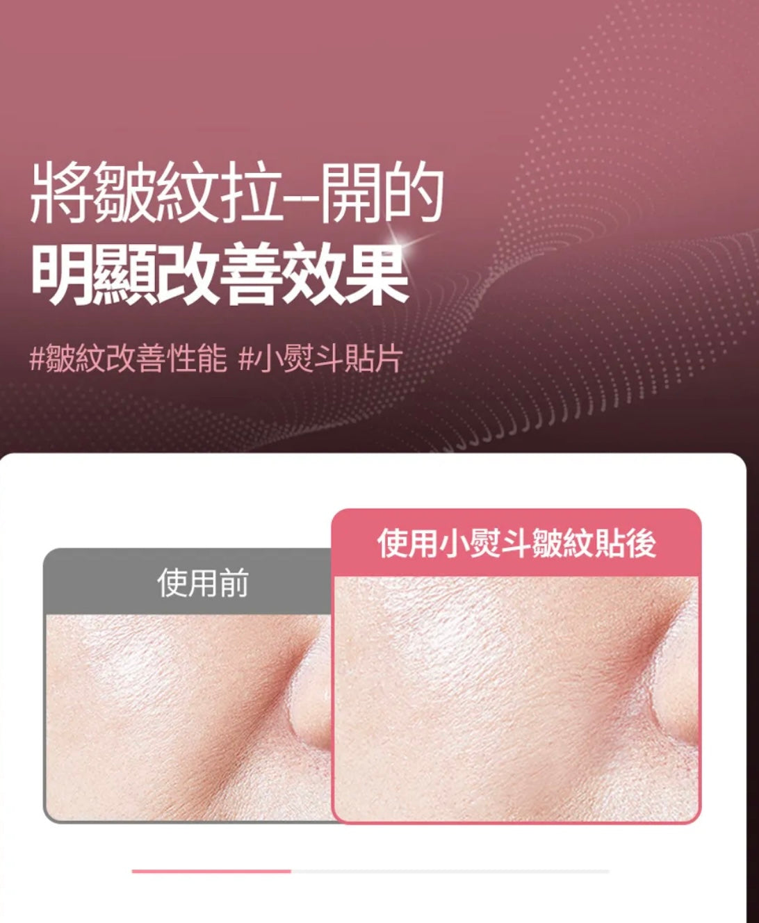 肌膚越用越年輕！Face Fit Wrinkle Patch 小熨斗皺紋貼 ⭐️