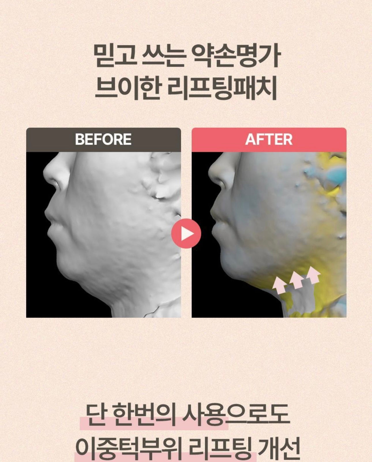 YAKSON BEAUTY V面緊緻提拉帶🧏🏻‍♀️