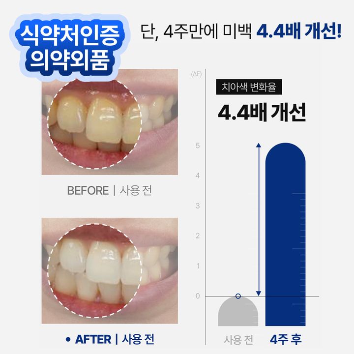 4周見效！Proval Smile Balm 牙齒美白拋光精華🤍🦷