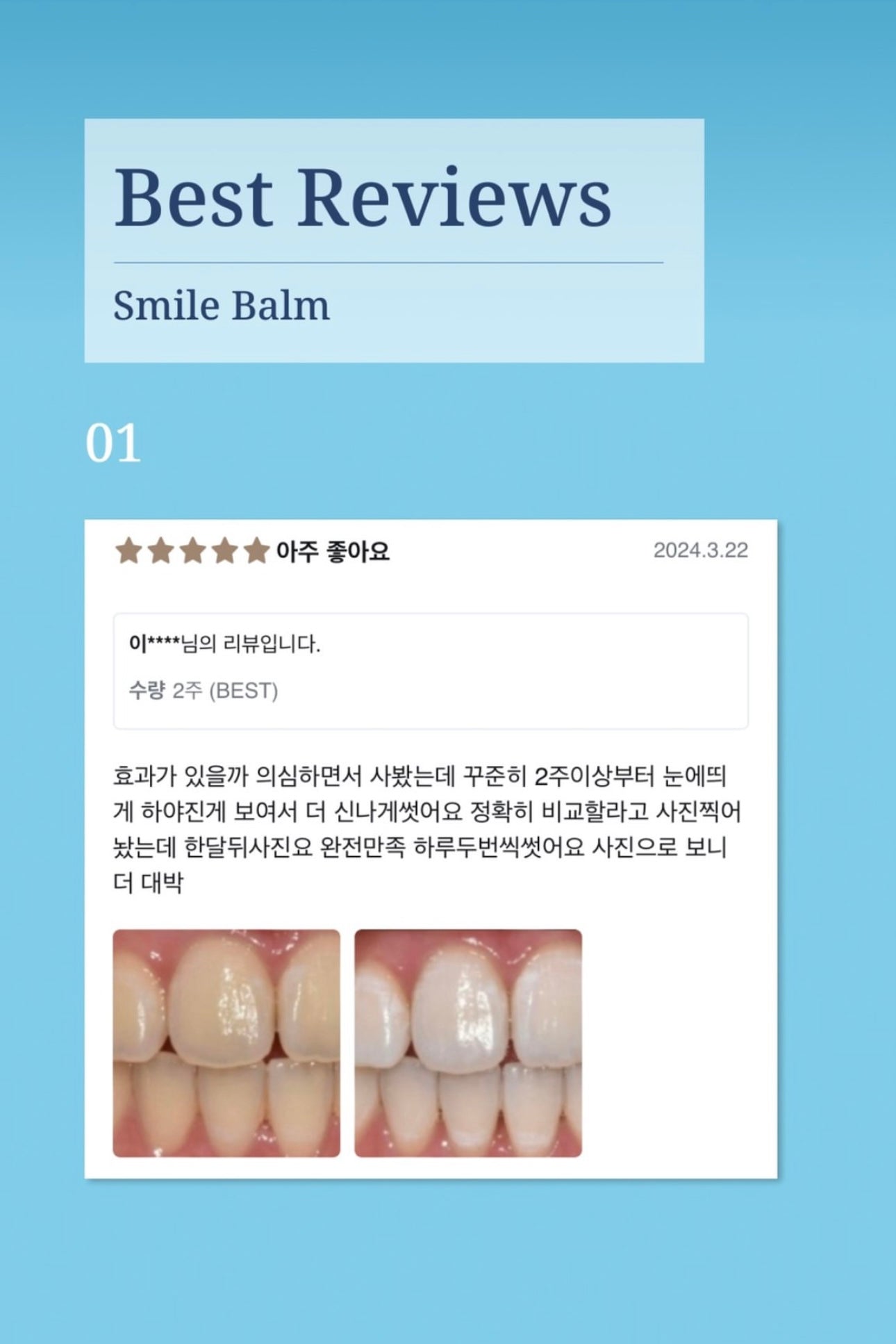 4周見效！Proval Smile Balm 牙齒美白拋光精華🤍🦷