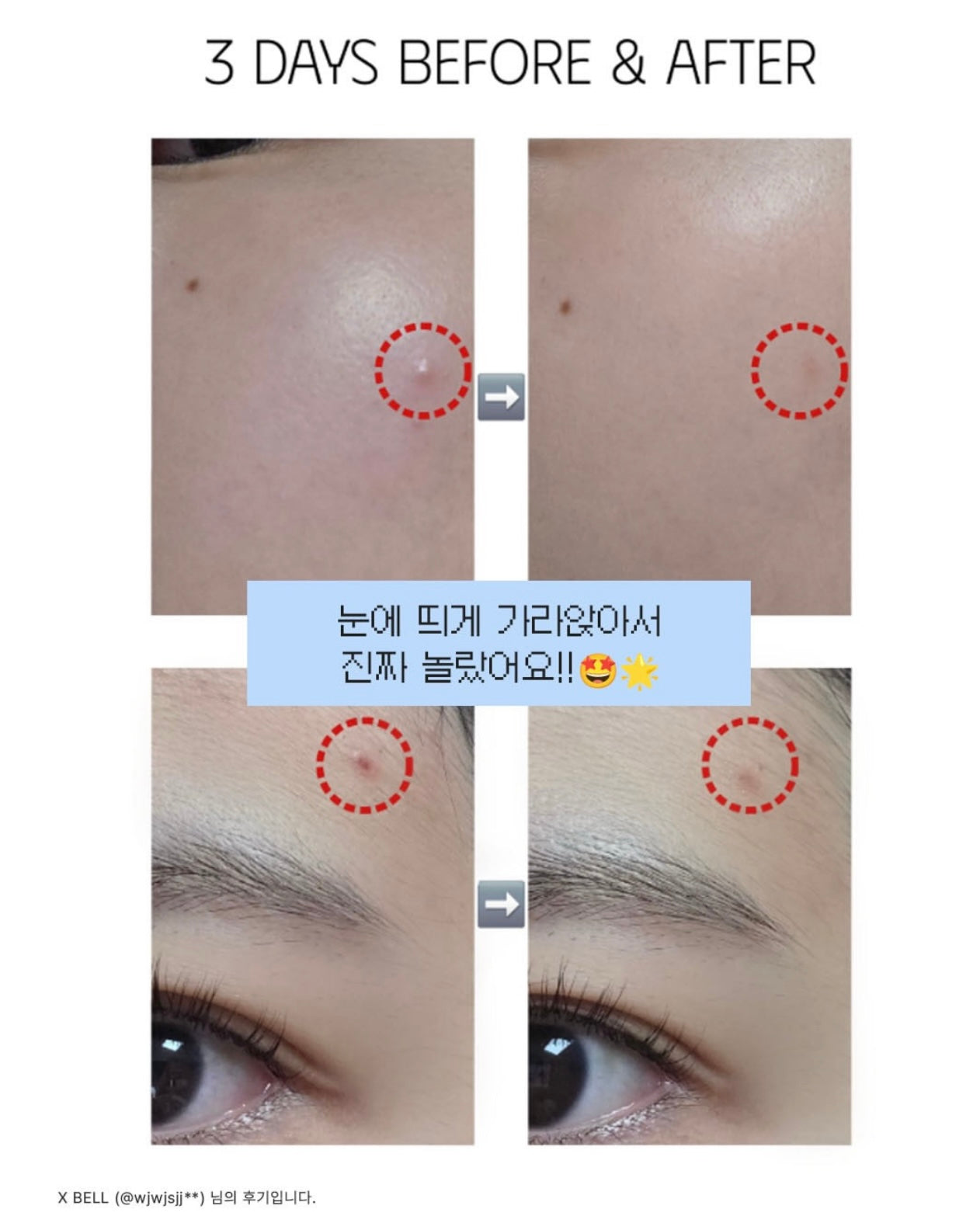 「斷貨預警」🚨 Isoi亮白舒緩淡斑精華💫去黃淡斑淡印最有感 💡 Brightening Calming Spot Serum