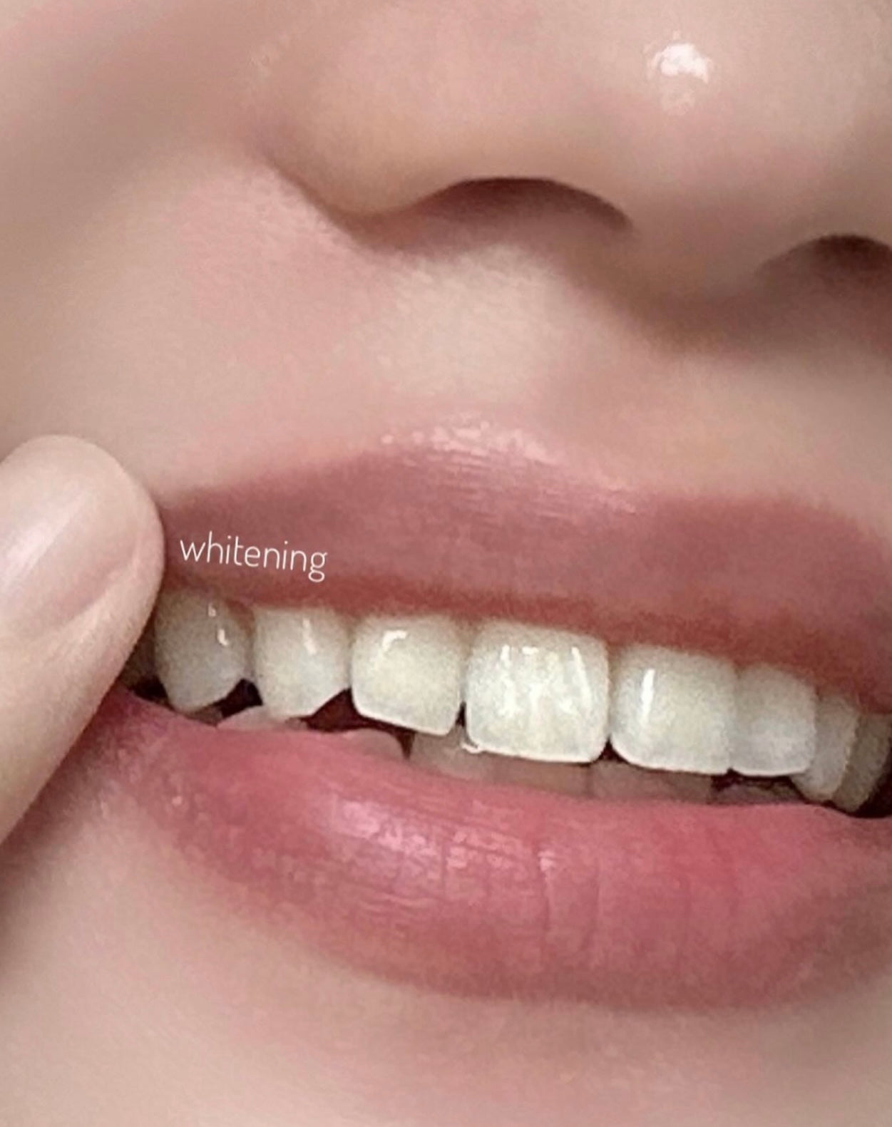 4周見效！Proval Smile Balm 牙齒美白拋光精華🤍🦷