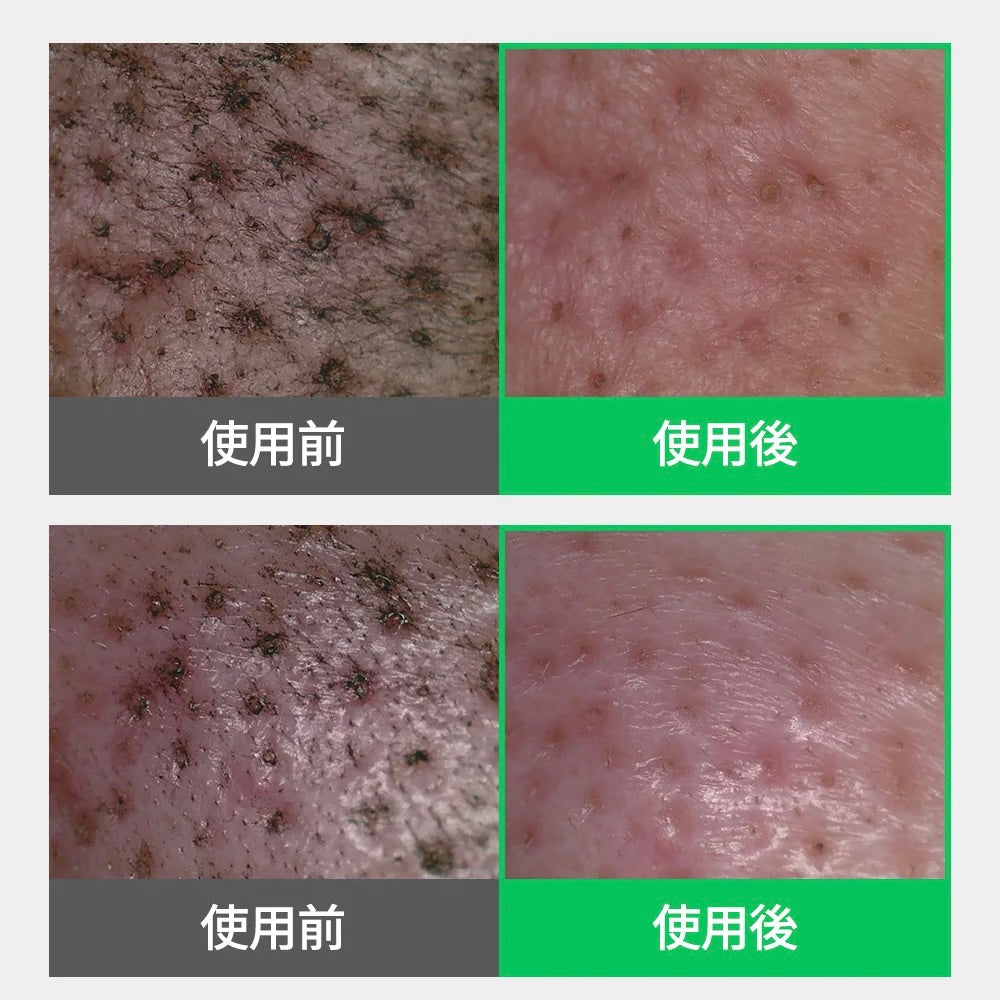 Sungboon Editor綠番茄精華淨化毛孔雙效卸妝油🍅💚| Sungboon Editor Green Tomato Deep Pore Double Cleansing Ampoule Oil