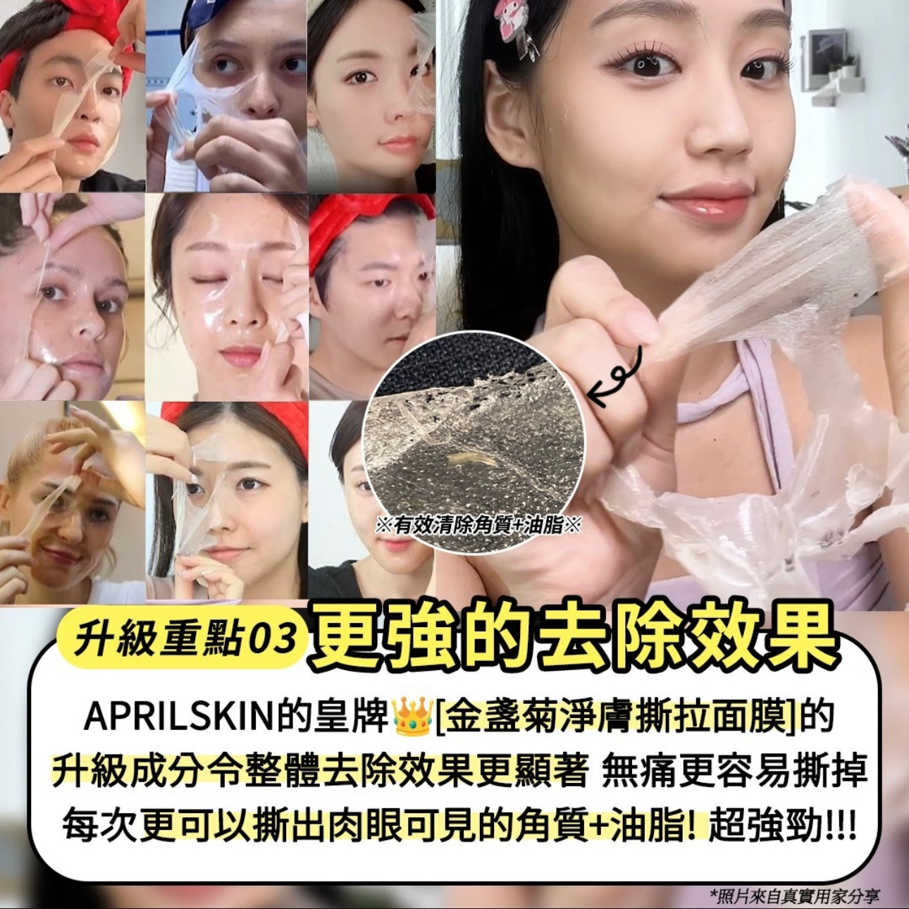 5冠王No.1及glowpick獎項🥇| Aprilskin金盞菊去黑頭粉刺撕拉面膜🌼 Aprilskin Real Calendula Peel Off Pack