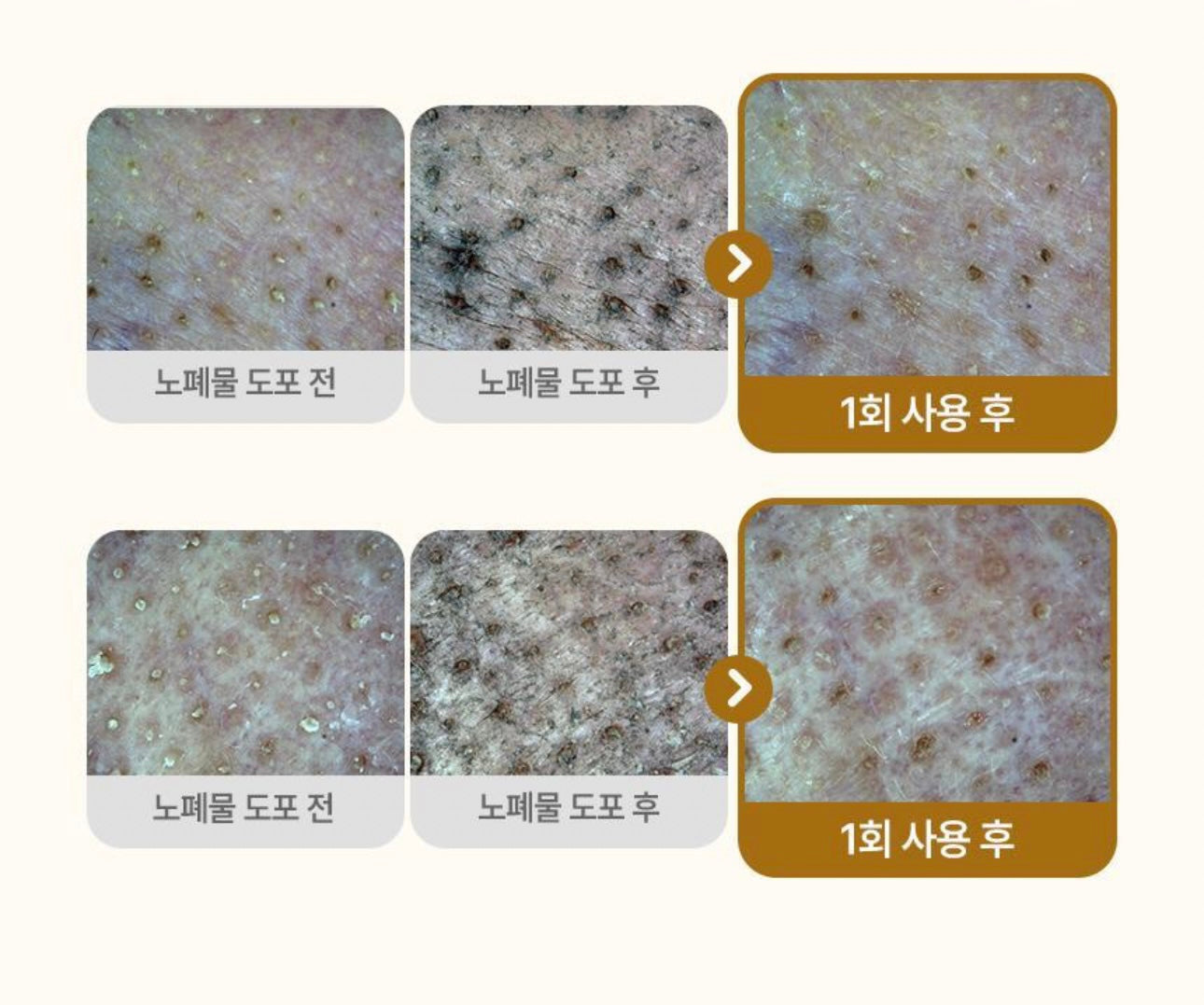 附贈洗面刷 + 薯薯貼紙|聯名限定ILSO穀物馬鈴薯淨膚泡泡潔面 🥔 限量發售🎁