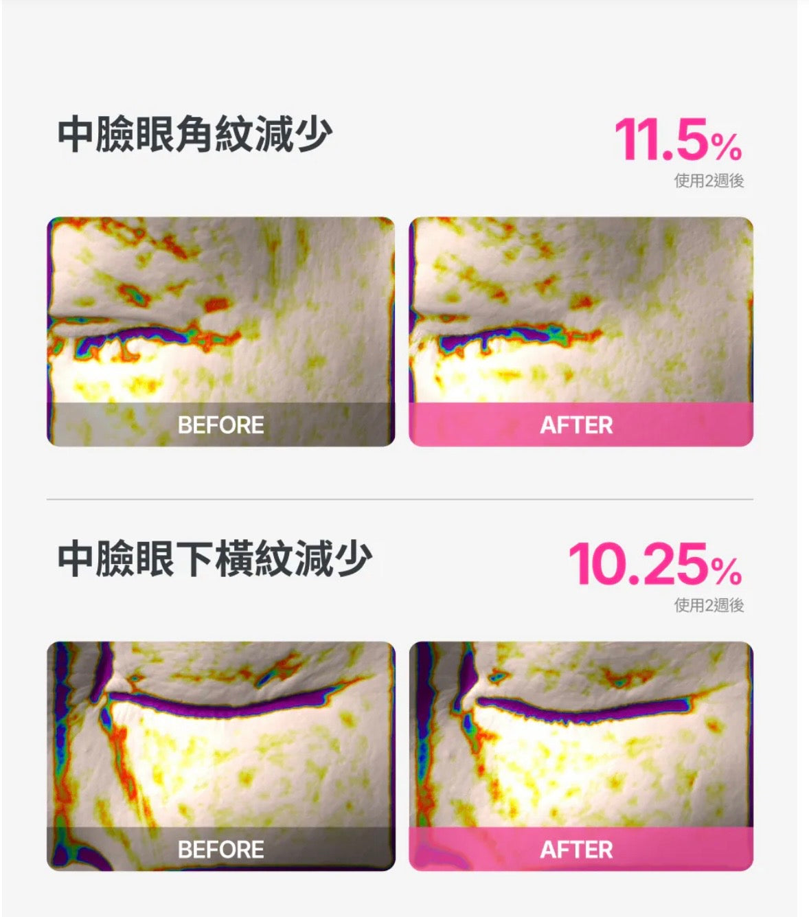 肌膚的「急救CPR」✨ THOME CPR 三效協同抗皺緊致急救精華🌙 幫你一秒抹去歲月痕跡、重現彈潤少女肌！Thome CPR Triple-Synergy Wrinkle Care Serum