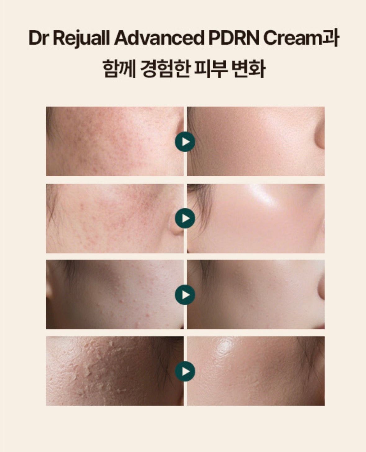 韓國藥房款🏥Rejuall 麗珠蘭高濃度PDRN底層修復再生霜⭐️|  Rejuall Advanced PDRN Rejuvenating Cream