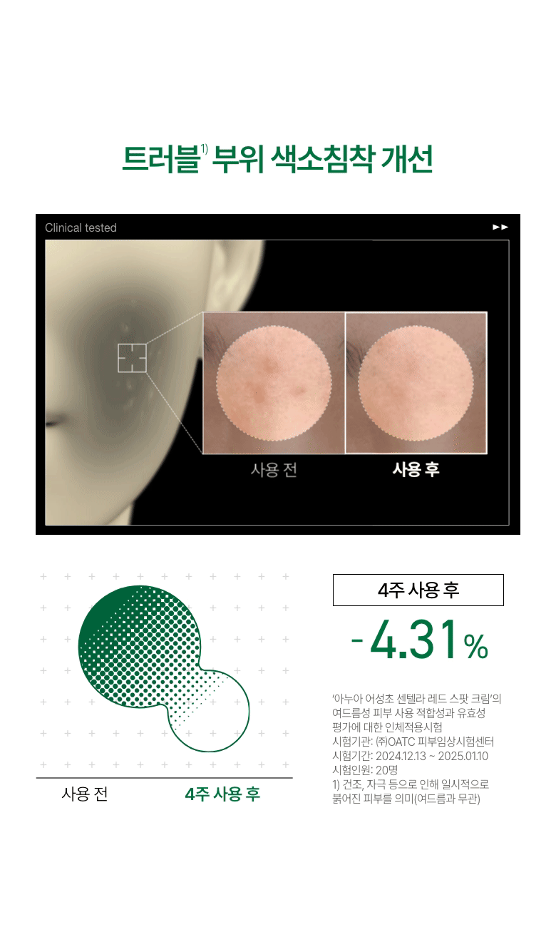 ANUA心葉草 + 積雪草去痘修護霜🌿