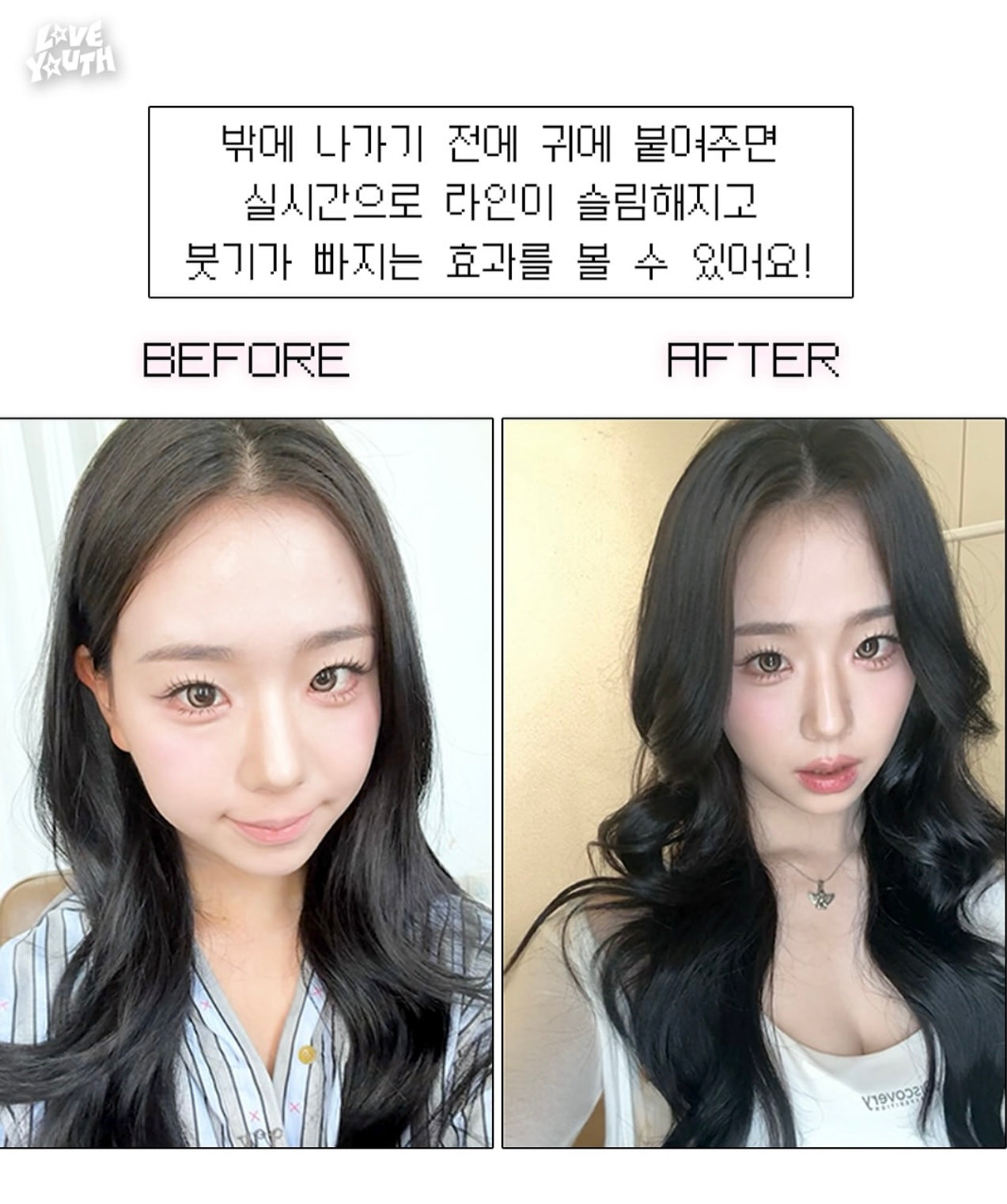 穴位療法 × 美感設計🔥Dr.wonder 穿戴式無痛耳穴貼| 耳朵上的療癒時刻| 非侵入式的療癒方式💆🏼‍♀️