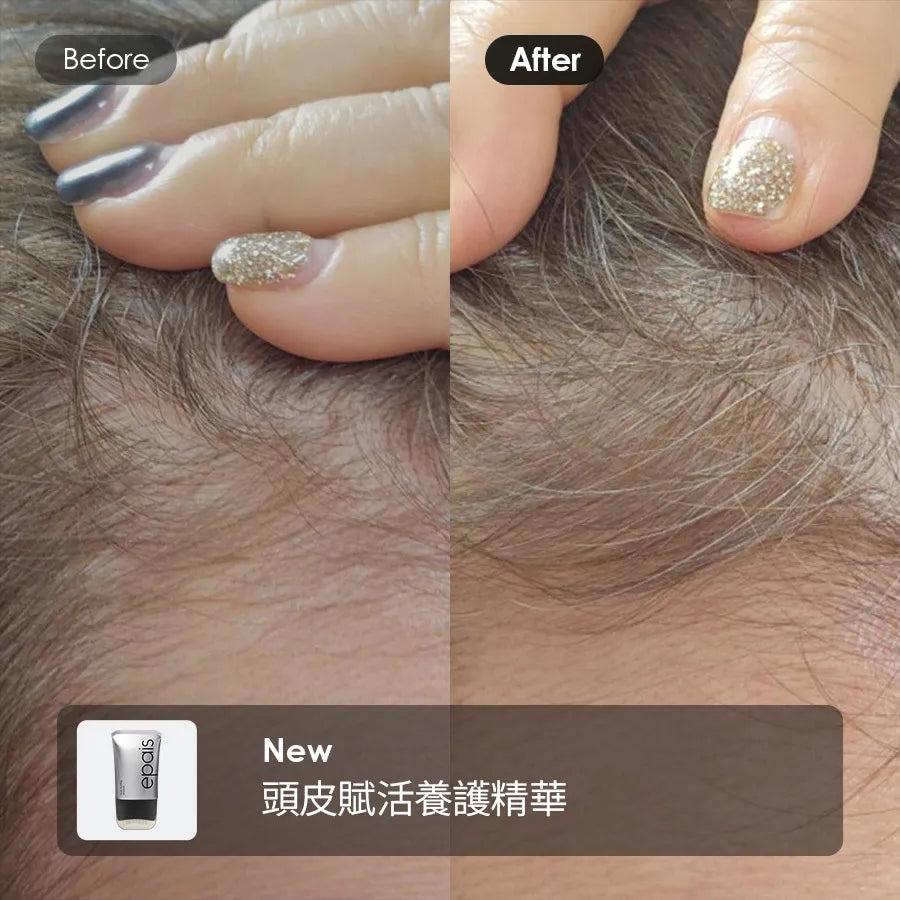 🔥【防脫髮僅需2星期】EPAIS 髮根賦活頭皮精華 🩶 EPAIS Scalp Boosting Ampoule✨