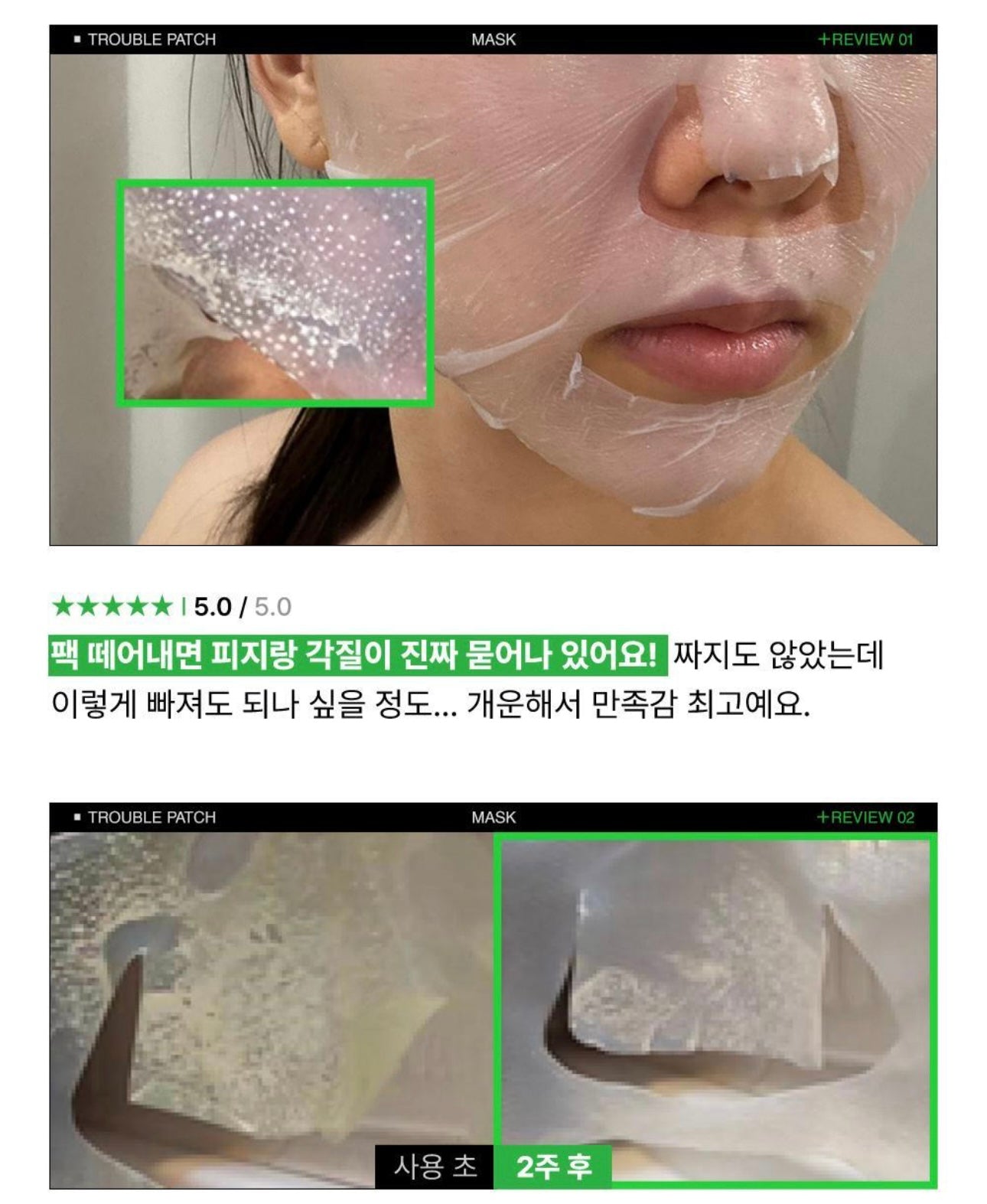 全面瑕疵的大型救星✨ EIoM 縮時淨痘粉刺調理修護面膜EIoM Trouble Patch Mask
