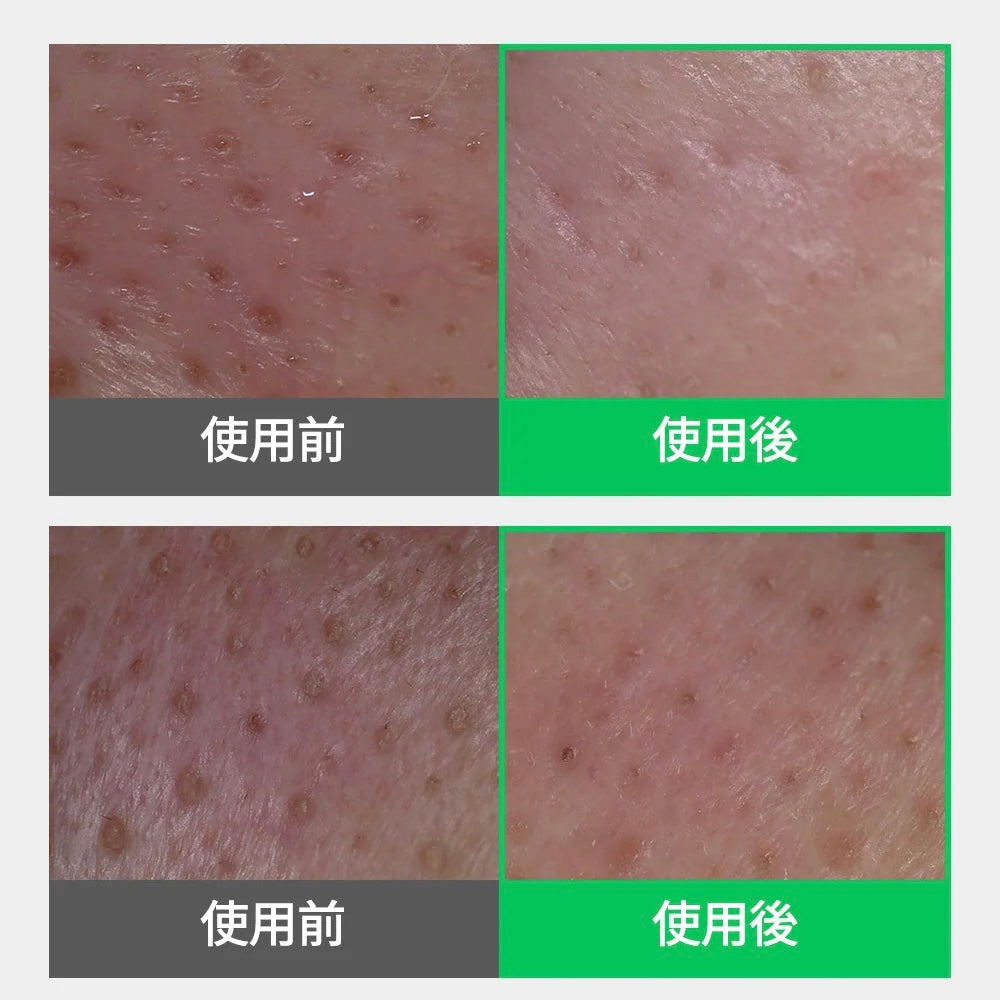 Sungboon Editor綠番茄精華淨化毛孔雙效卸妝油🍅💚| Sungboon Editor Green Tomato Deep Pore Double Cleansing Ampoule Oil