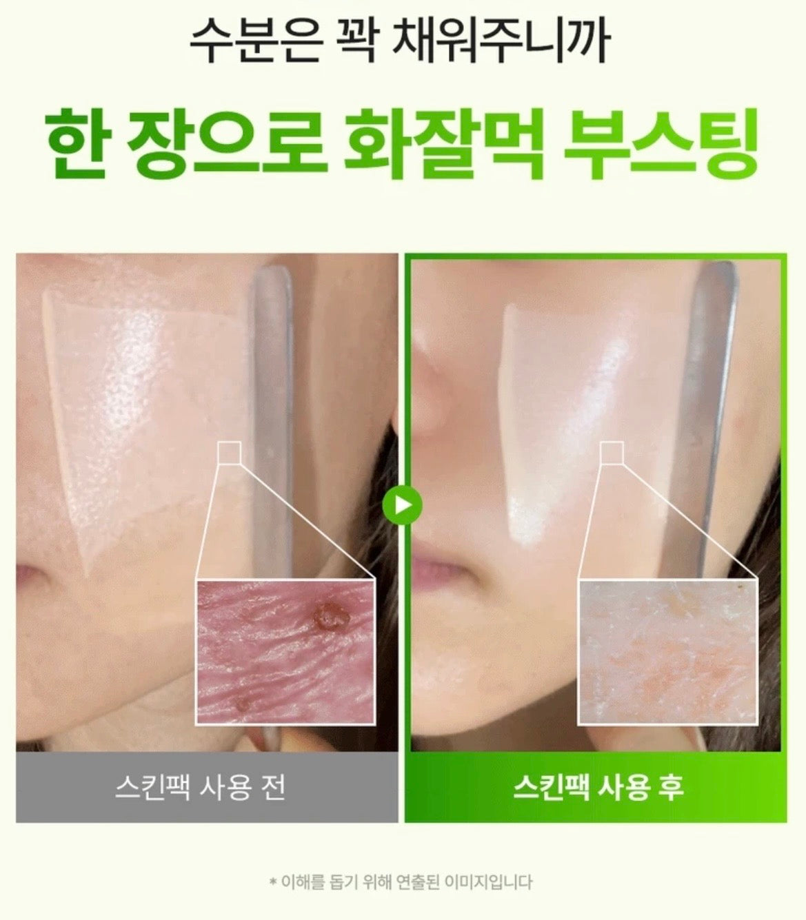 🌊 爆款搶購！Mommy Care 海洋葡萄毛孔冰鎮濕敷貼片💚 Mommy Care Sea Grape Pore Refining Skin Pack