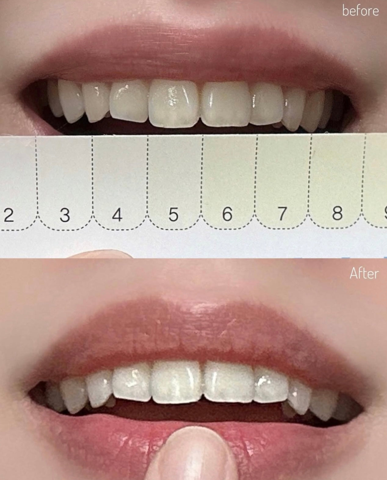 4周見效！Proval Smile Balm 牙齒美白拋光精華🤍🦷