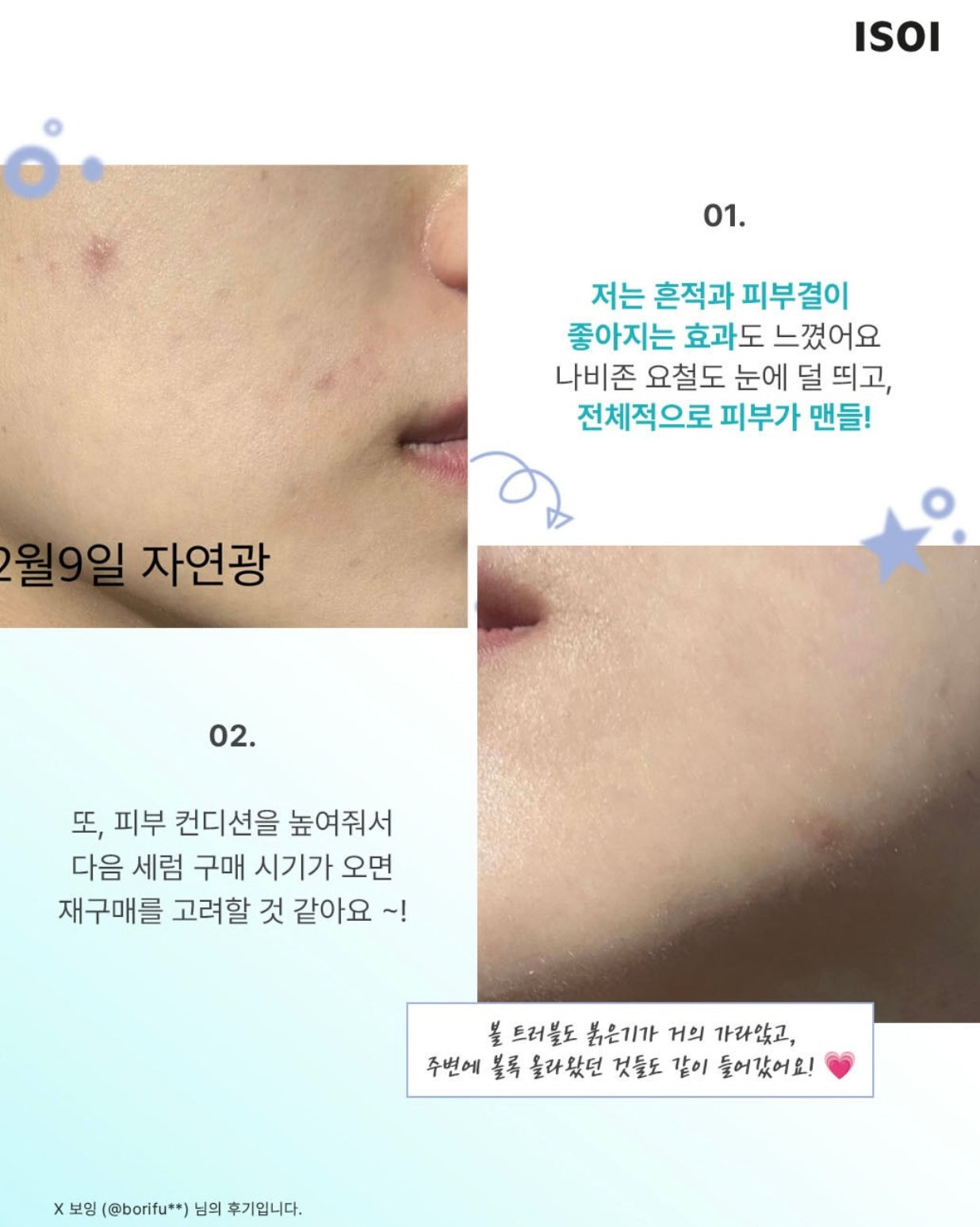 「斷貨預警」🚨 Isoi亮白舒緩淡斑精華💫去黃淡斑淡印最有感 💡 Brightening Calming Spot Serum