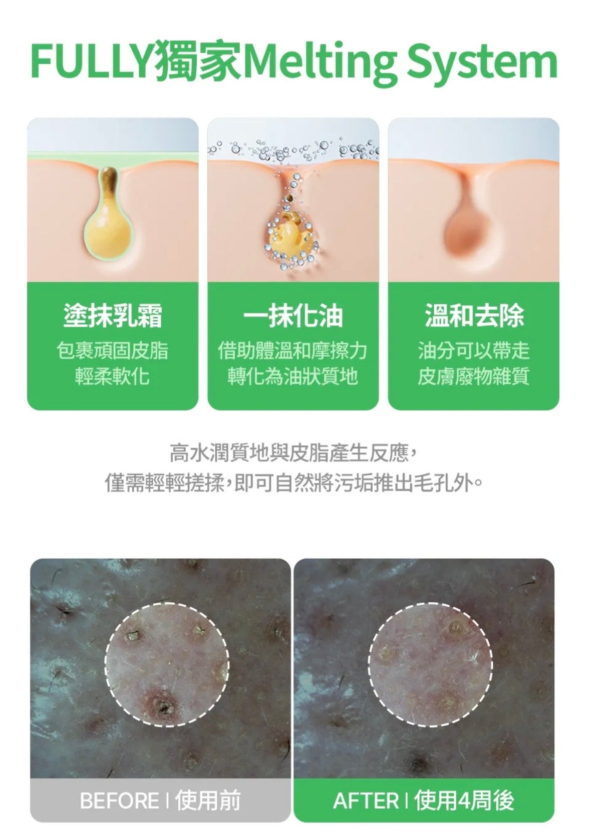 粉刺黑頭終結者✨FULLY 草本溫和胜肽溶解毛孔溶脂霜💚 輕抹粉刺皮脂一粒粒咁出嚟🔥 FULLY PORE PEPTIDE SEBUM MELTING CREAM TO OIL