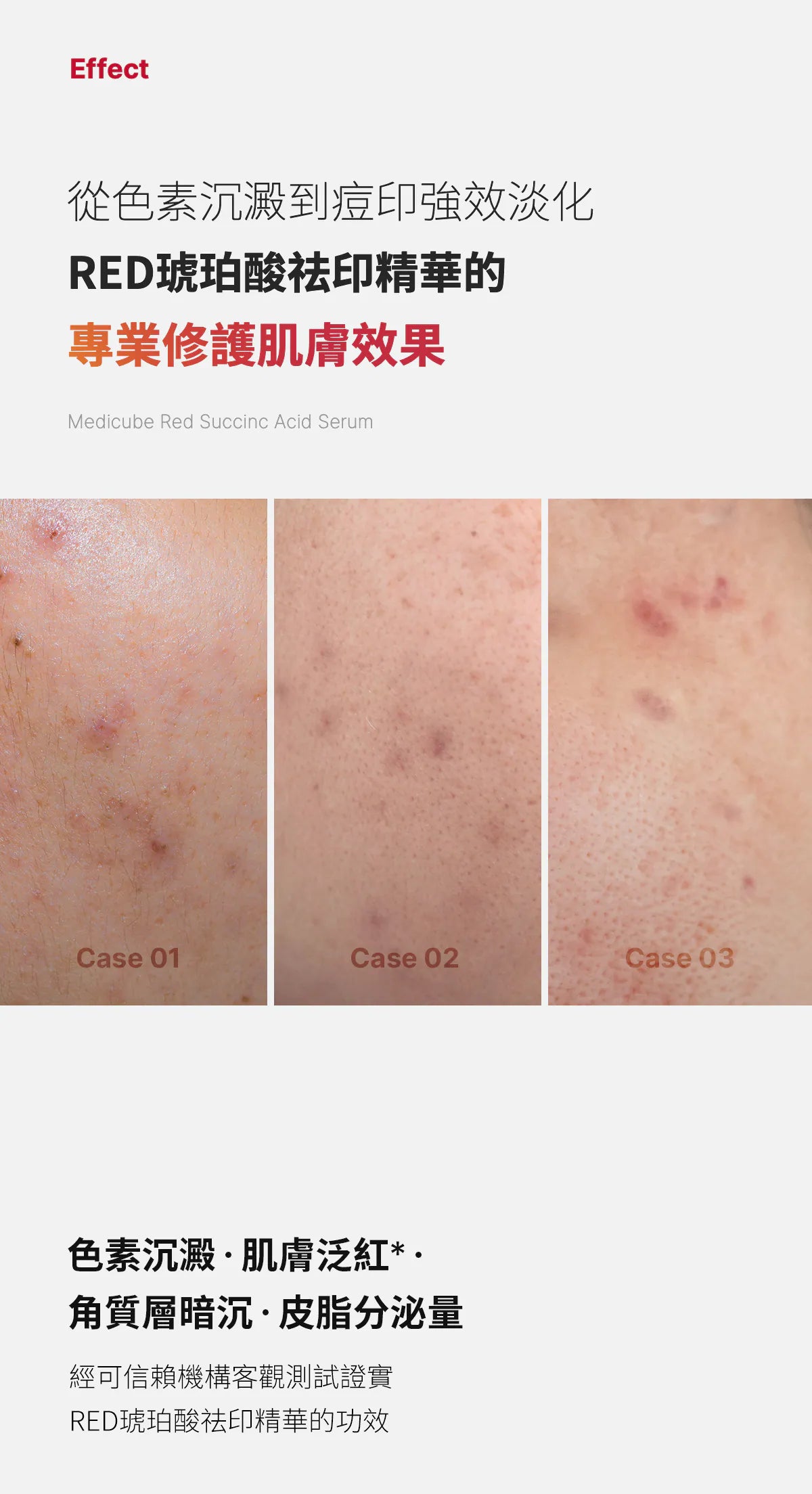 精華+棉片優惠價中💫 RED琥珀酸祛印精華 +RED琥珀酸煥顏爽膚棉