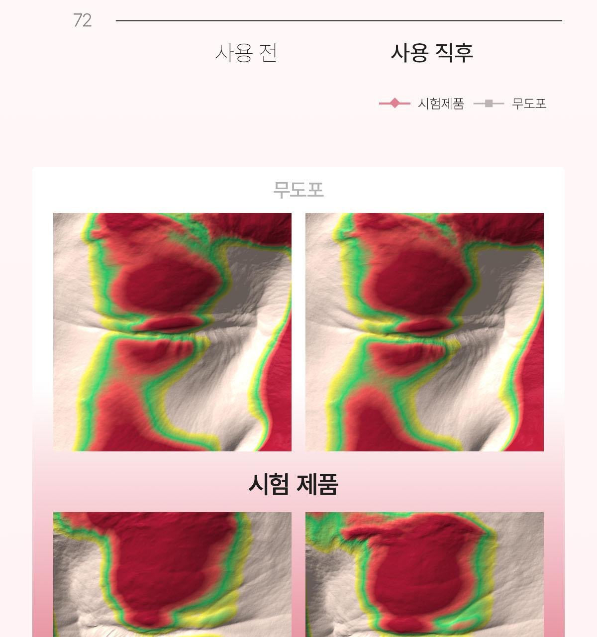 👀✨ 歐陽娜娜也瘋狂！💖 敷出少女感！ Biodance 高濃度膠原蛋白/魚子醬PDRN果凍眼膜