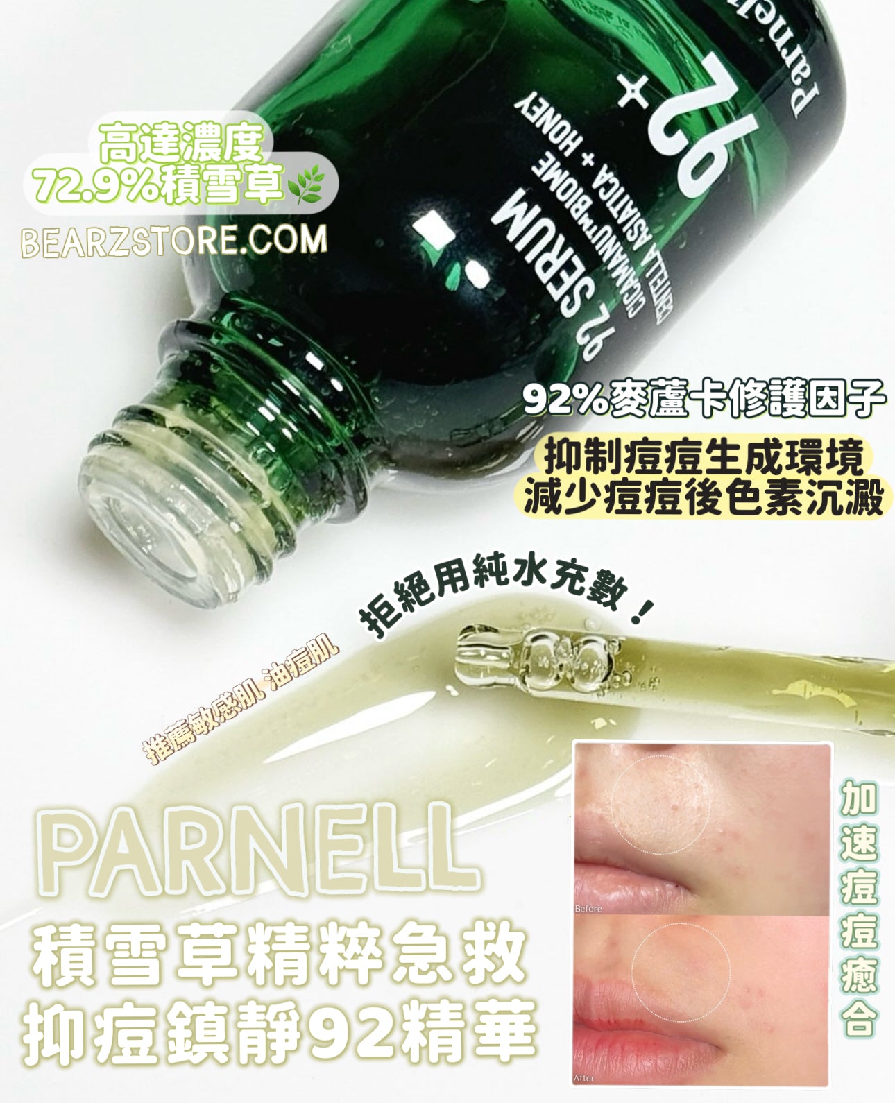 Parnell積雪草精粹急救抑痘鎮靜92精華🌿| Parnell Cicamanu 92 Serum 刺激的肌膚兩週內回復狀態💚