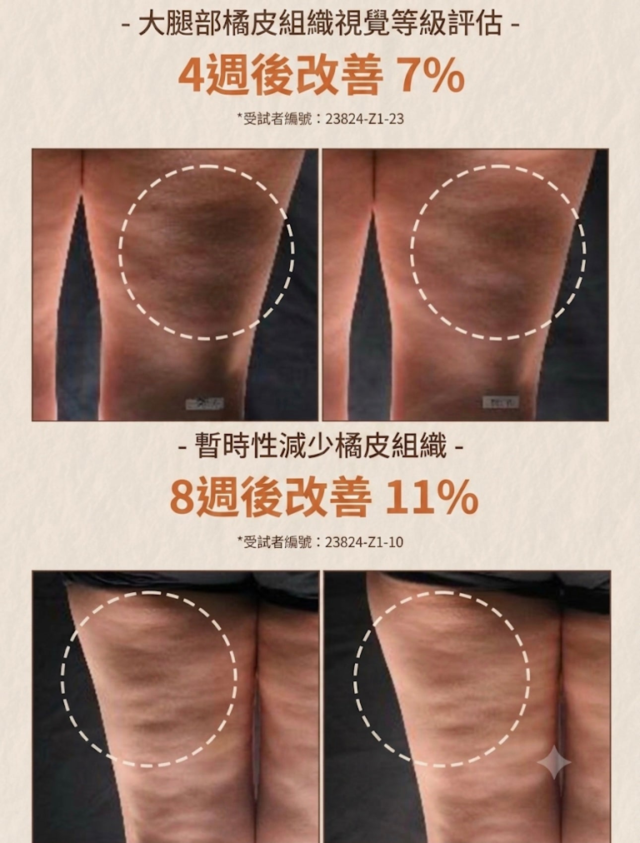 ✨ 「消水腫神器」！  Nutseline 堅果香氛橙皮紋緊緻美體乳🌰 | Nutseline Aroma Nut Slim Fit Body Lotion
