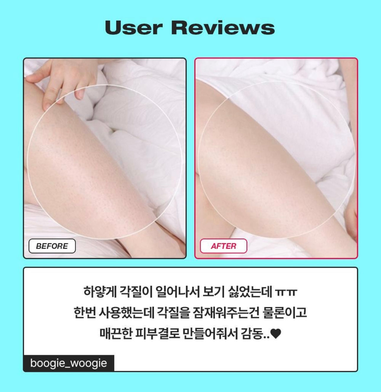 1,000萬張銷量神話🧼 Laundryou 柔滑身體去角質美白清潔片 🥊✨ Laundryou Peeling Pad For Body