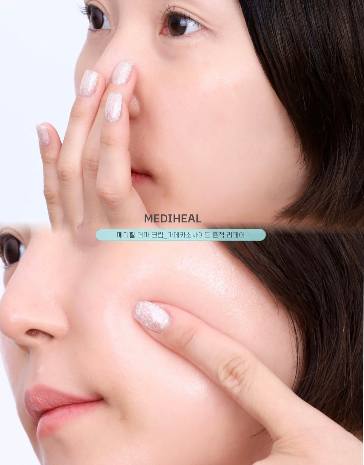 MEDIHEAL 98%積雪草抗炎去印去痕跡修護霜🩵| MEDIHEAL MADECASSOSIDE DERMA ACTIVE CAPSULE CREAM