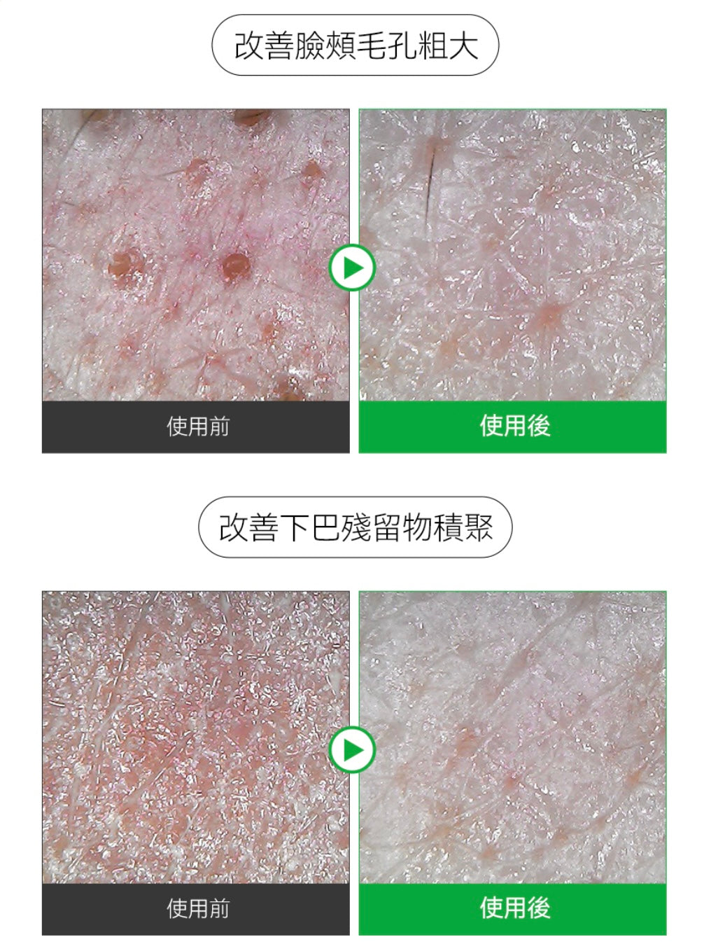 SUNGBOON EDITOR綠蕃茄零毛孔深層洗面乳✨| SUNGBOON EDITOR GREEN TOMATO DEEP PORE CLEANSING ULTRA WHIPPING FOAM💚