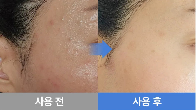最新版本🔥Dr.Deep 煥膚奇蹟霜✨水嫩無瑕 4D 去印修護霜Dr.Deep Clinical Texture Turnover Spot Cream