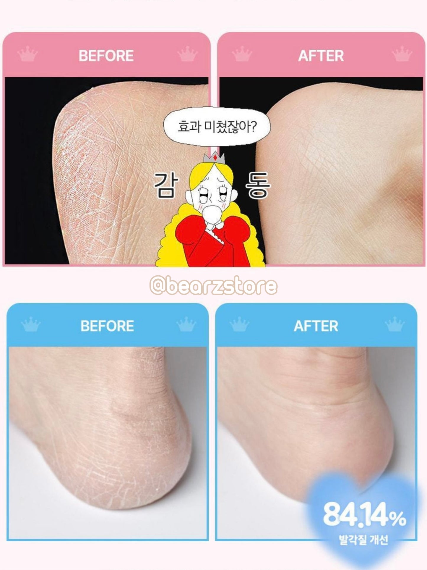 送死皮刮刀✨Plu 強效角蛋白強化修護足霜+完美足部去角質套裝 🦶🏻| PLU Intensive Repair Foot Cream