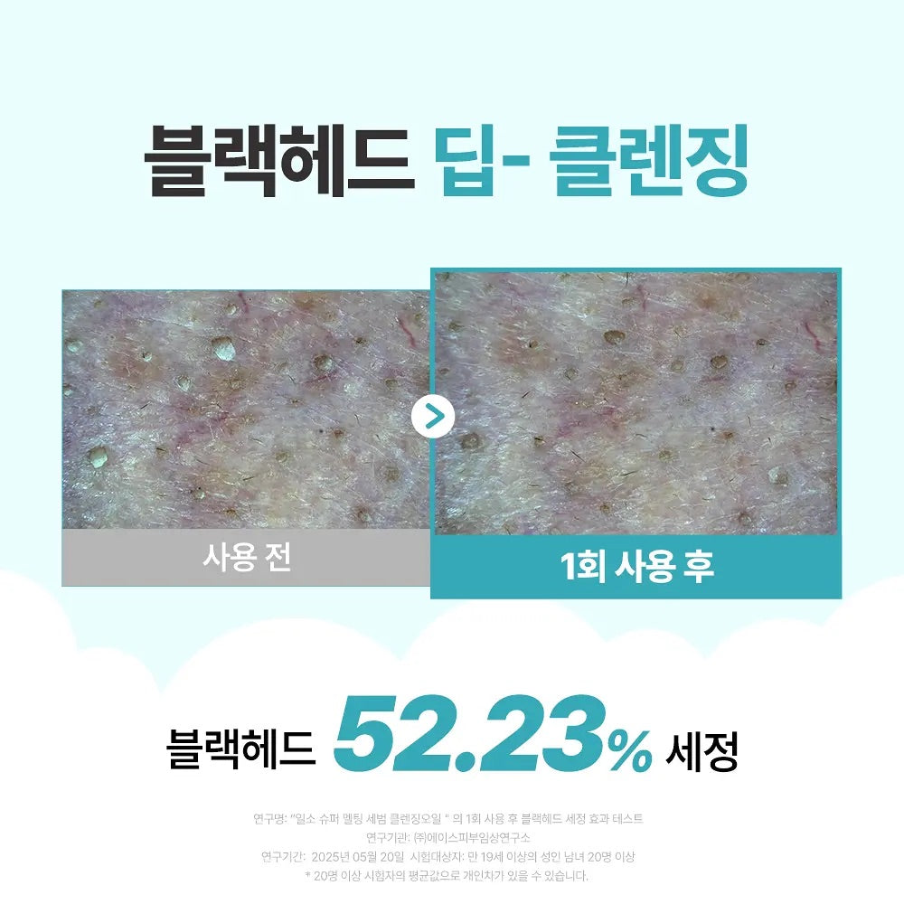 送土豆熊髮圈✨ ilso x 土豆熊限量版天然溫和溶黑頭清毛孔卸妝油套裝Ilso natural mild cleansing oil set🪄