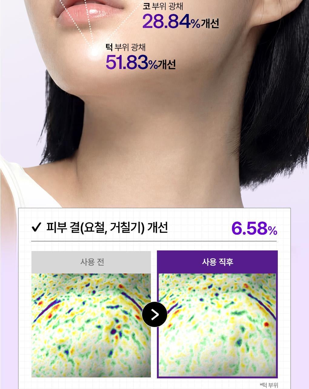 🔥 毛孔隱形小紫瓶！新品✨MEDIHEAL PDRN 毛孔彈力精華💜 MEDIHEAL DERMA SERUM PDRN PORE