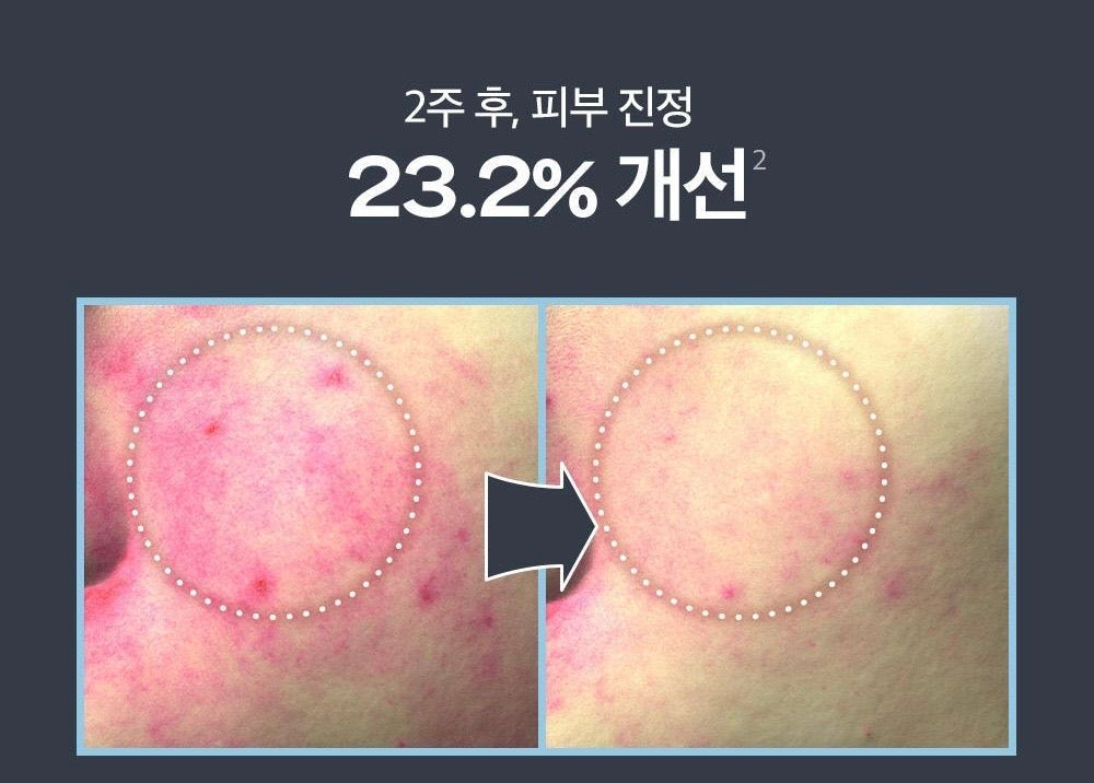 多送30ml🌿 刷酸天花板！PAULA'S CHOICE 2%水楊酸精華液 PAULA'S CHOICE BHA Liquid Exfoliant
