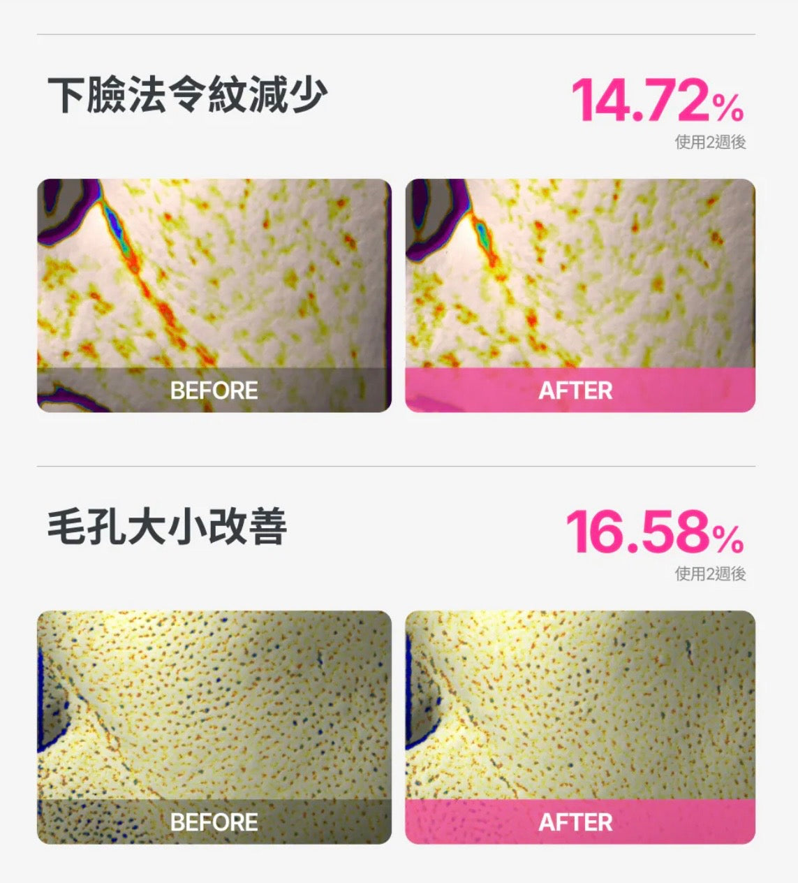 肌膚的「急救CPR」✨ THOME CPR 三效協同抗皺緊致急救精華🌙 幫你一秒抹去歲月痕跡、重現彈潤少女肌！Thome CPR Triple-Synergy Wrinkle Care Serum