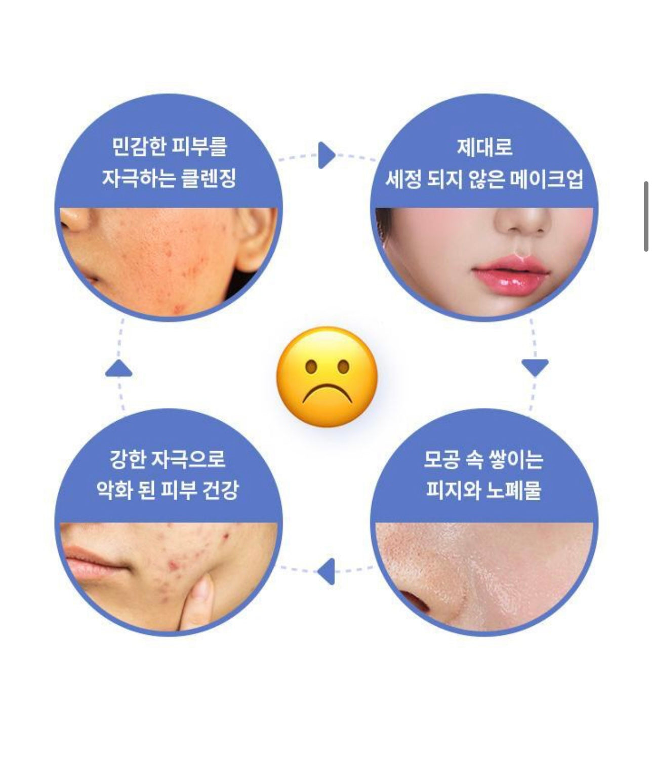 Banila Co皇牌零感舒緩鎮靜深層潔淨卸妝膏💖 Banila Co Clean It Zero All In One Cleanser