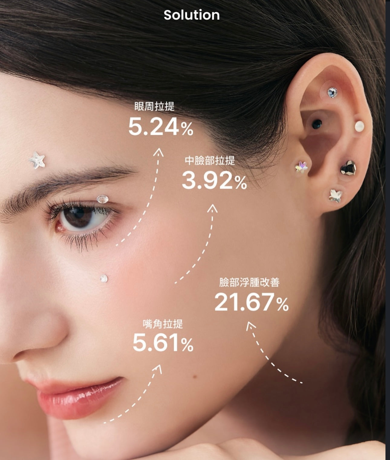 穴位療法 × 美感設計🔥Dr.wonder 穿戴式無痛耳穴貼| 耳朵上的療癒時刻| 非侵入式的療癒方式💆🏼‍♀️