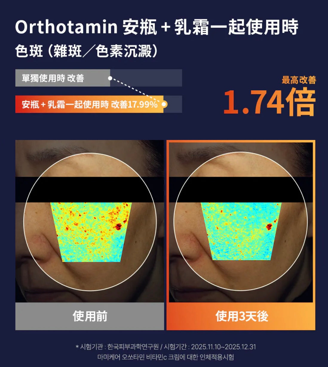高效溫和✨Mommycare Orthotamin 15高純維C極致淡斑逆齡乳霜 ✨