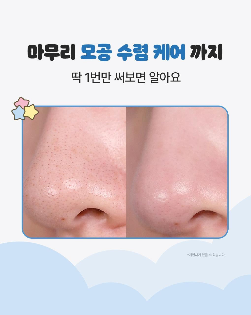 Ilso x 土豆熊限量特別版💖黑頭粉刺必試款🧹| Ilso溶解皮脂收毛孔導出液套裝 Ilso Super Melting Sebum Softener🦋