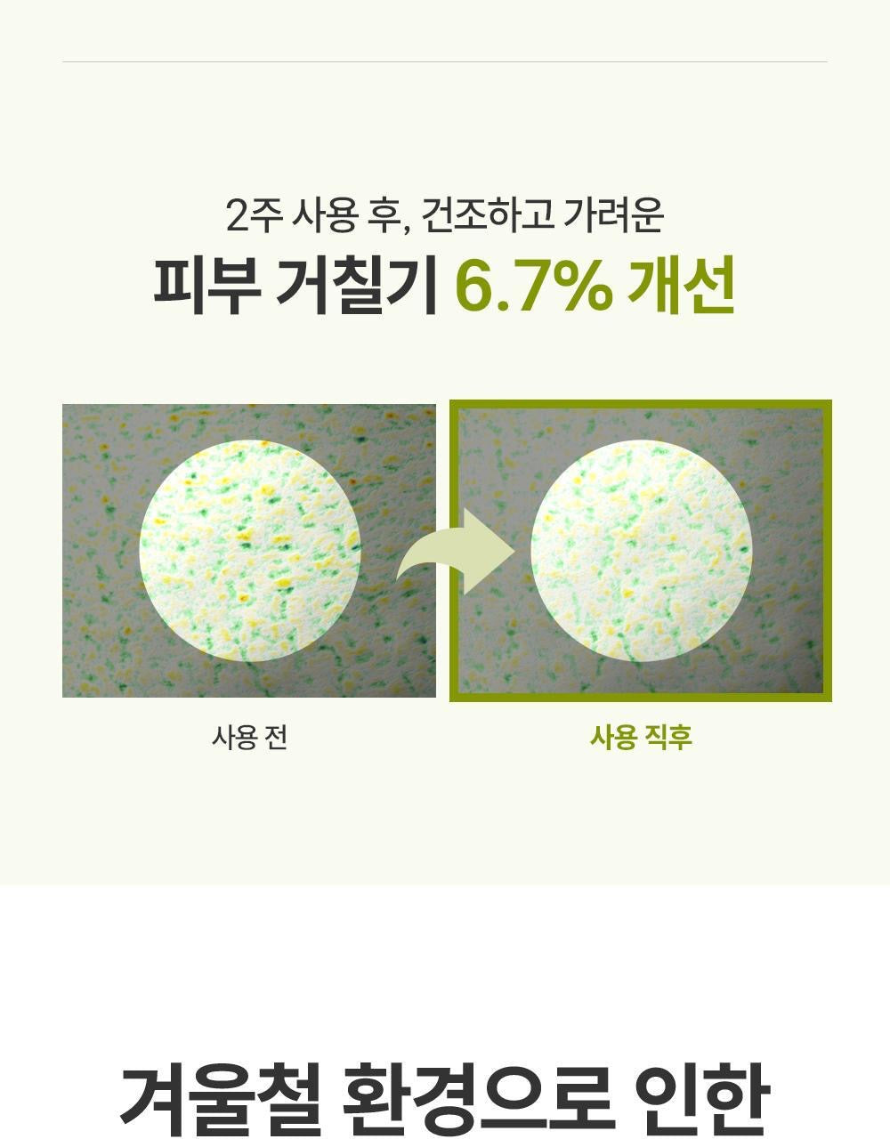 ZEROID 急救密集修護霜| 榮獲 2025 OLIVE YOUNG 大賞「MD推薦」🏆