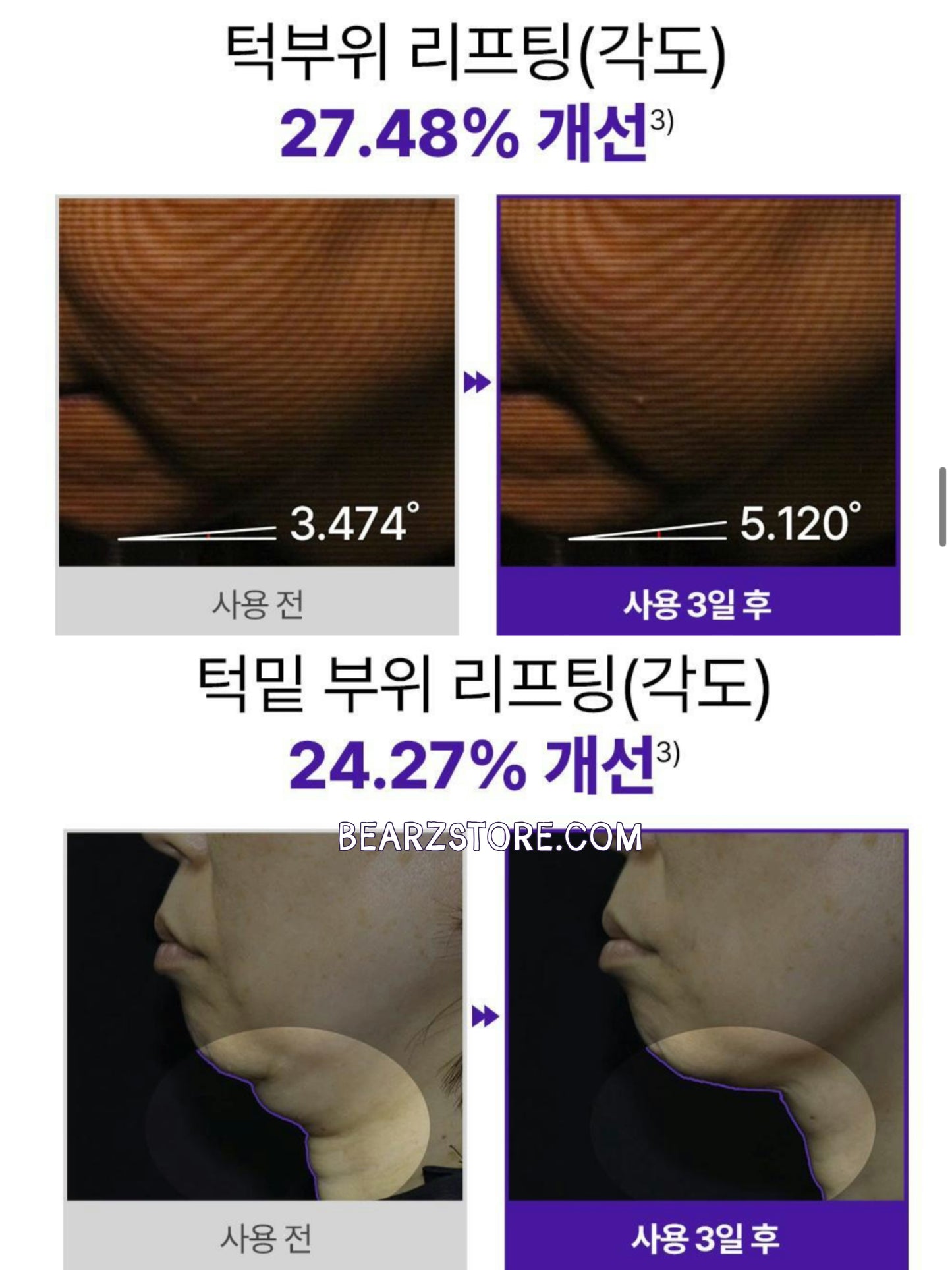 ✨ 抗老黑科技！一夜拉出「少女緊緻線」🪄Dermafirm 500道爾頓超微分子膠原蛋白微針彈力拉提貼💉