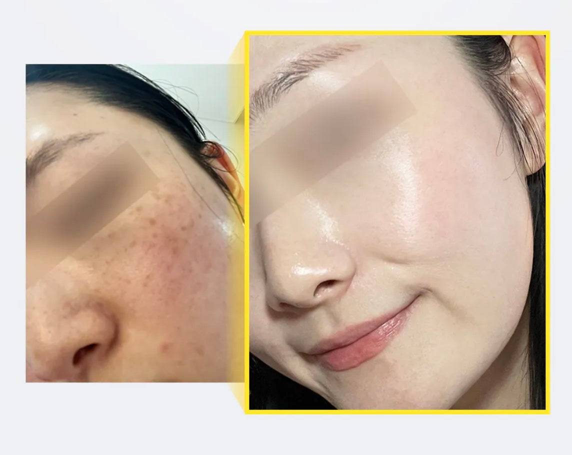 高效溫和✨Mommycare Orthotamin 15高純維C極致淡斑逆齡乳霜 ✨