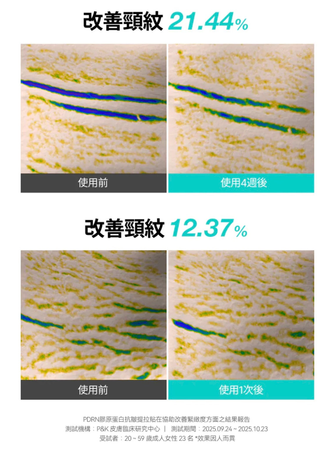 天鵝頸的作弊神器🪿✨ ANUA PDRN 膠原微米無痕熔岩逆齡頸貼🪄 ANUA PDRN COLLAGEN MELTING PATCH FOR NECK