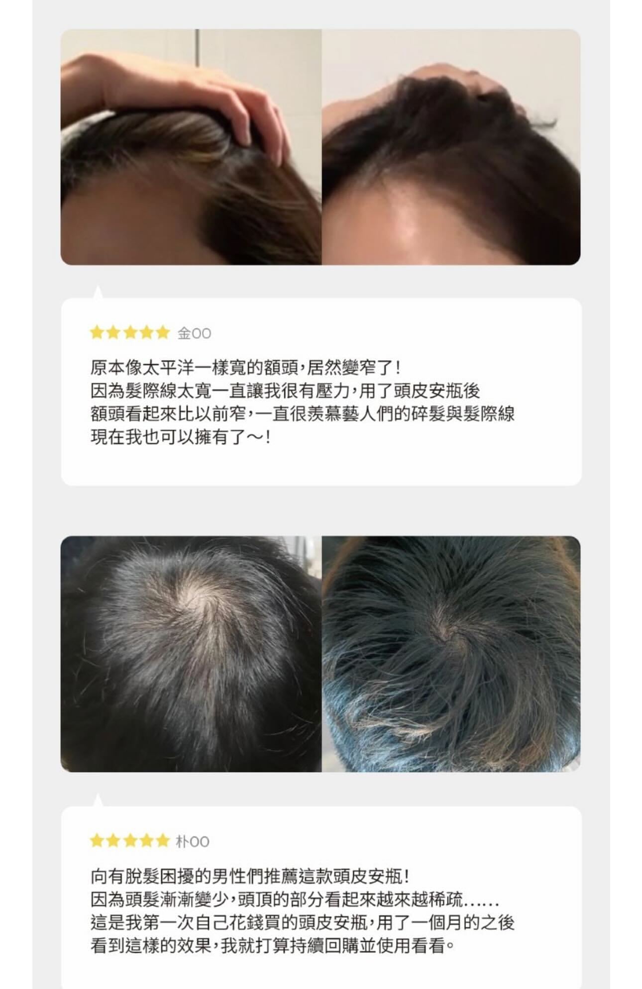 韓國最新黑科技🔥Lilyeve GROW:TURN 防脫育髮外泌體頭皮精華✨| 自帶刷頭☁️