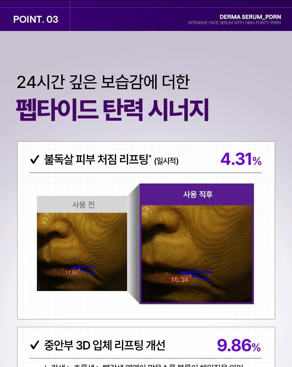 🔥 毛孔隱形小紫瓶！新品✨MEDIHEAL PDRN 毛孔彈力精華💜 MEDIHEAL DERMA SERUM PDRN PORE
