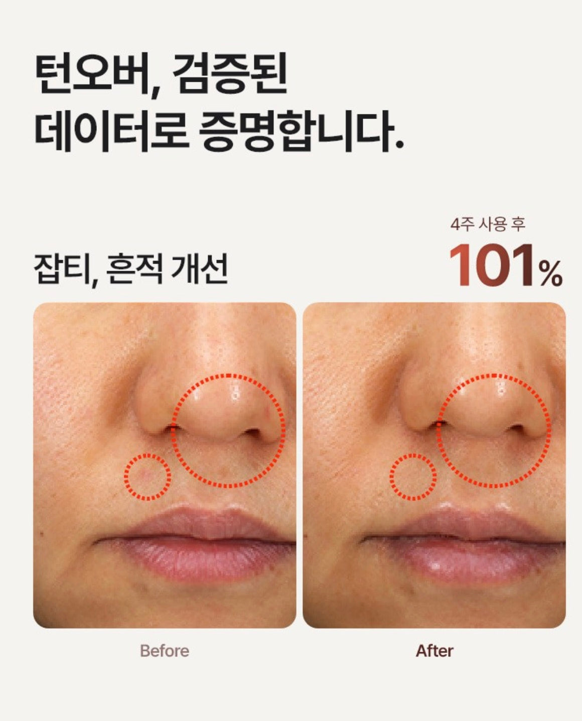 一週見效的即時感✨| MEDITHERAPY 抗痘修護視黃醛精華🌙| MEDITHERAPY Retinal Skin Booster Serum